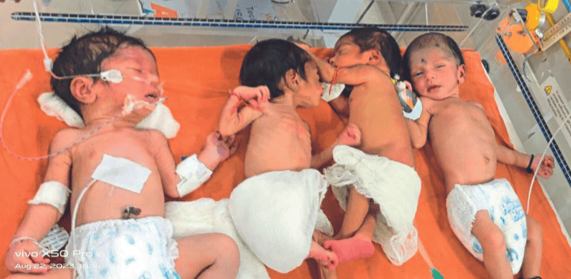 नंदुरबार येथे 389 आदिवासी बालके कुपोषणामुळे मृत्यूमुखी,
